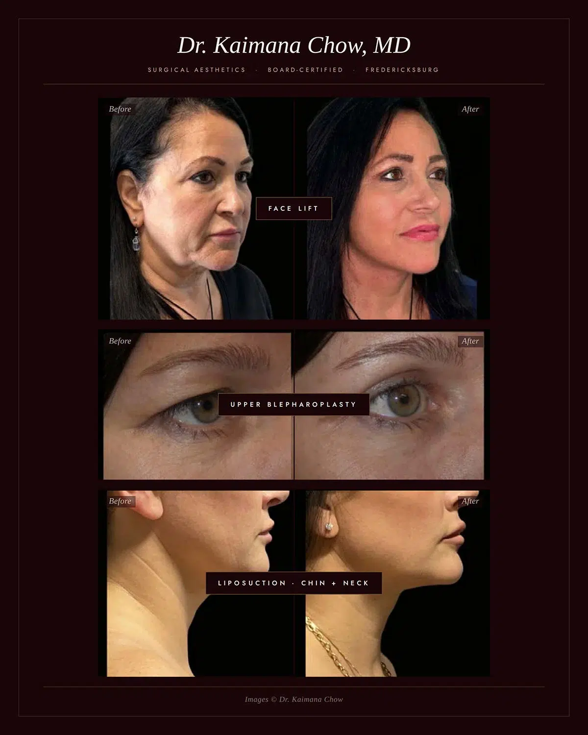Semi-permanent lip blushing result by Brianna at Veritas Backstage Austin medspa
