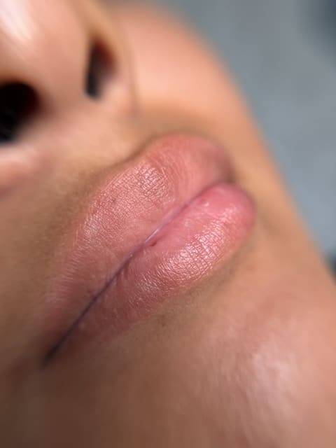 Permanent makeup before treatment — natural lips