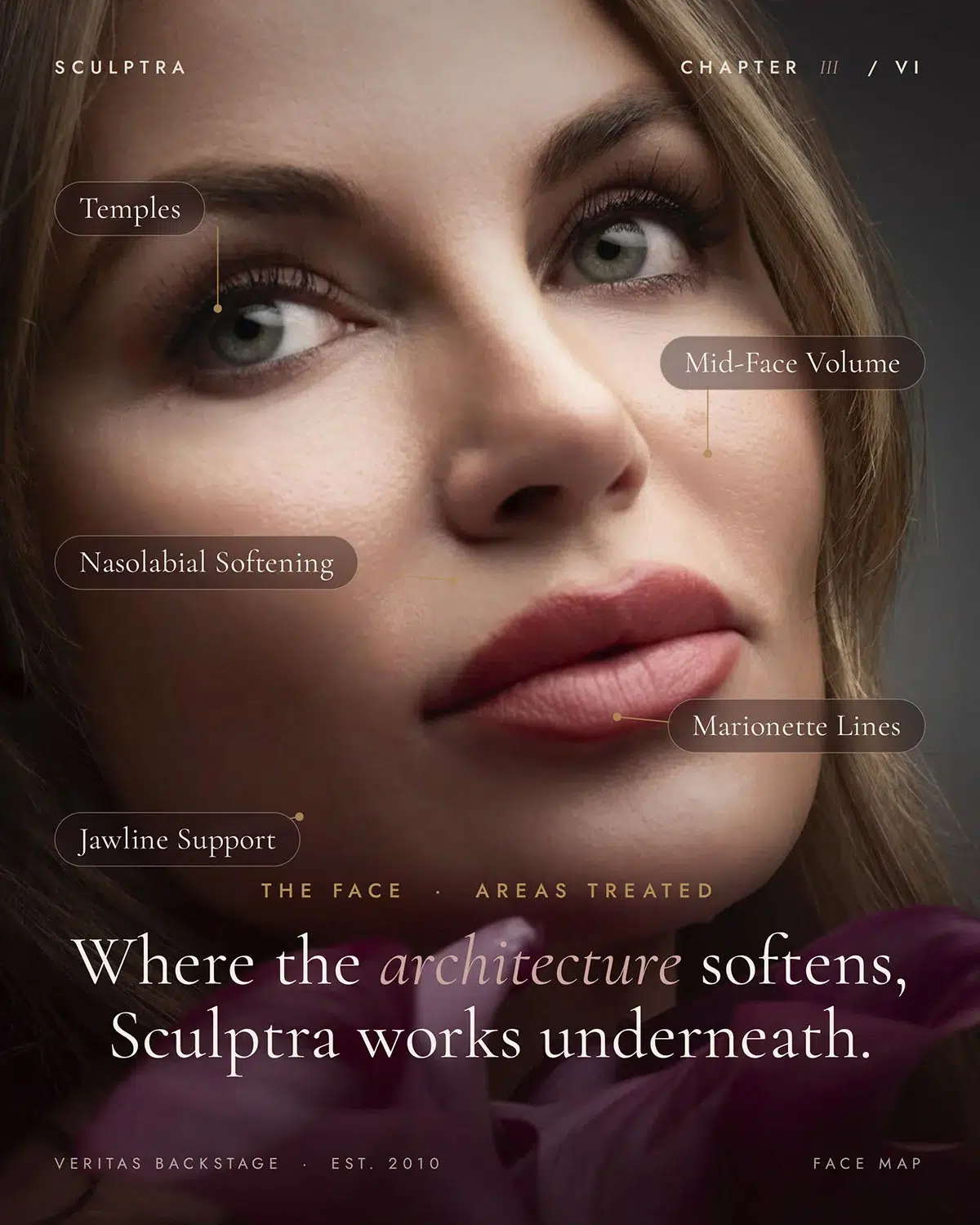 Sculptra, biostimulator -- for face and body — Veritas Backstage